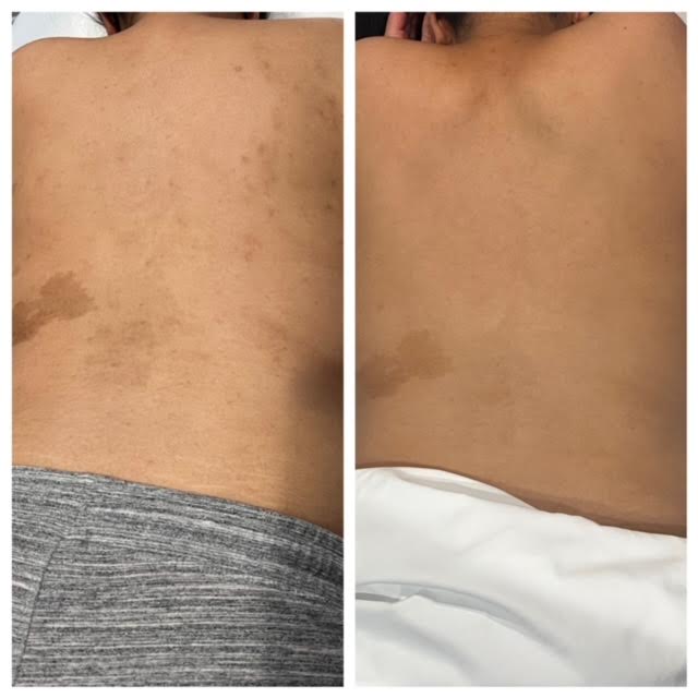 Radiance Peel Mini for Back in Vienna VA | Sechoir Beauty Bar